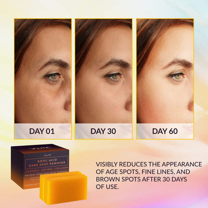 VALITIC Kojic Acid Dark Spot Remover Soap Bar with Vitamin C,Retinol,Collagen,Turmeric