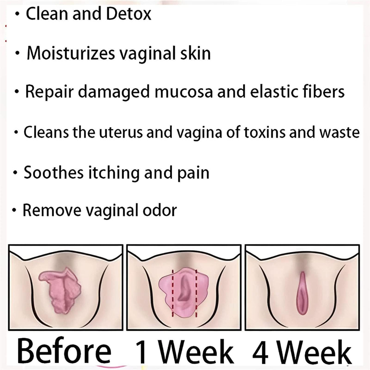 Dexcara Detox Repair, AnnieCare Natural Repair Vaginal Capsules, Anniecare Instant Anti