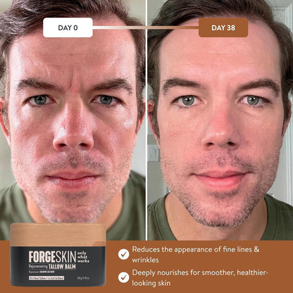 Forge Skin Face Moisturizer for Men Wrinkle Defense Beef Tallow Balm, 1.7oz | 100% grass-fed beef tallow, essential oils, paraben-free, no synthetic fragrance, minimizes look of fine lines, men 35+