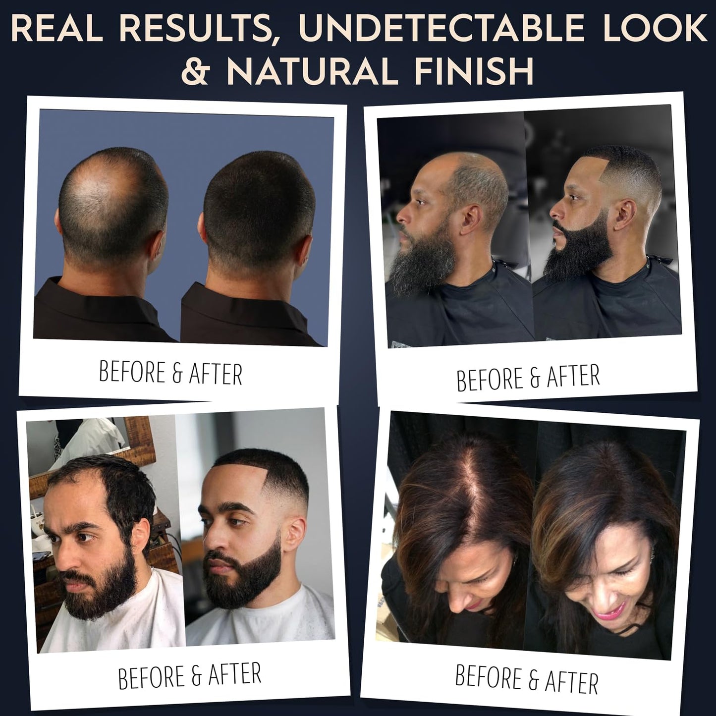 Hair Illusion Black Real Hair Fibers for Thinning Hair - 100% Natural Texture, Non Synthetic Hair Fibers - Bald Spot Cover Up for Women & Men - 38 Gram