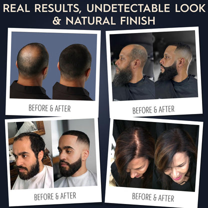 Hair Illusion Black Real Hair Fibers for Thinning Hair - 100% Natural Texture, Non Synthetic Hair Fibers - Bald Spot Cover Up for Women & Men - 38 Gram