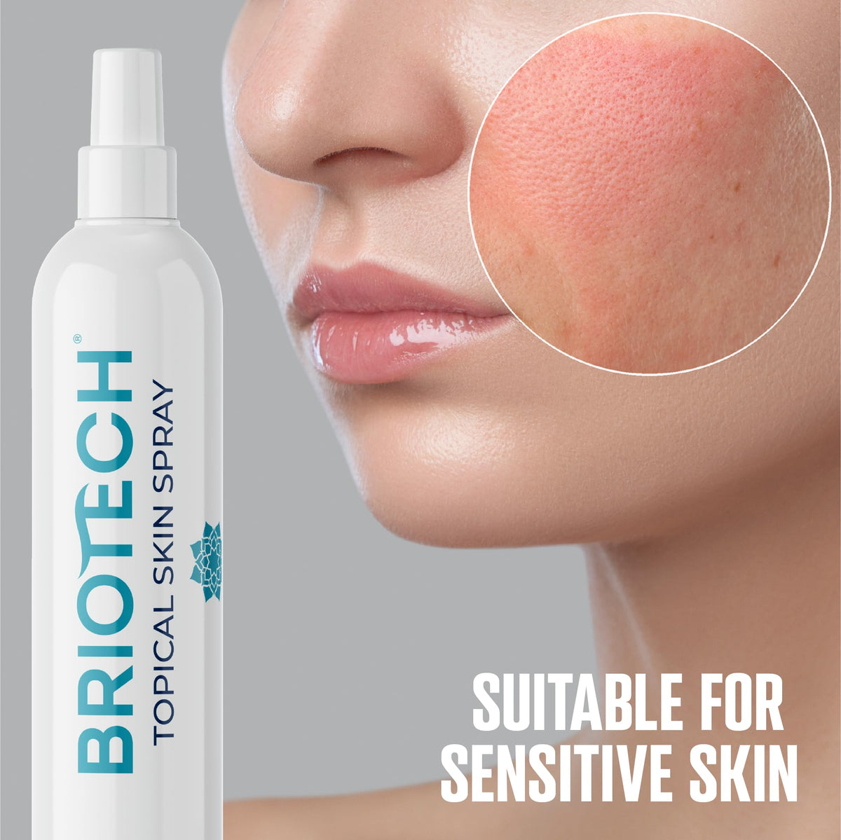 BRIOTECH Hypochlorous Acid Spray, Topical Skin Face & Body Mist, Support Irritations