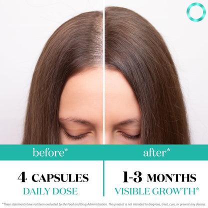 Women's Balance Hair Growth Supplements, Ages 45 and Up, Customer Proven for Visibly Thicker Hair and Scalp Coverage, Soy-Free, Made with 26 Ingredients including Beta Carotenes - 2 Month Supply