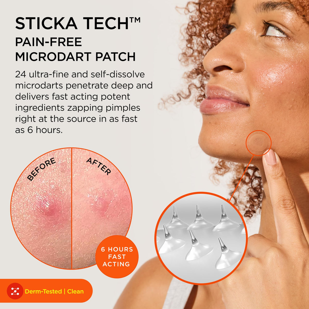 ZitSticka Killa Kit Microdart Pimple Patch For Face, Fast-Acting, 8 Count