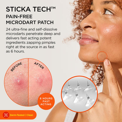 ZitSticka Killa Kit Microdart Pimple Patch For Face, Fast-Acting, 8 Count
