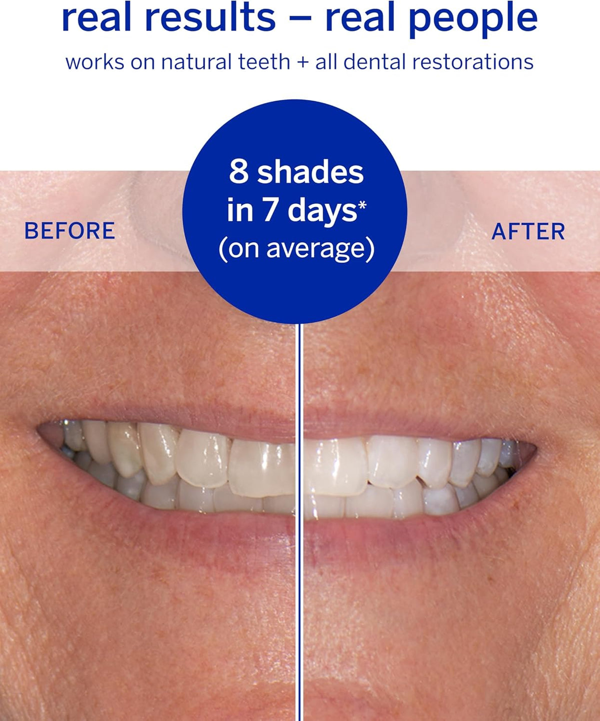 Supersmile Travel Whitening Kit, Toothpaste + Accelerator + Strips