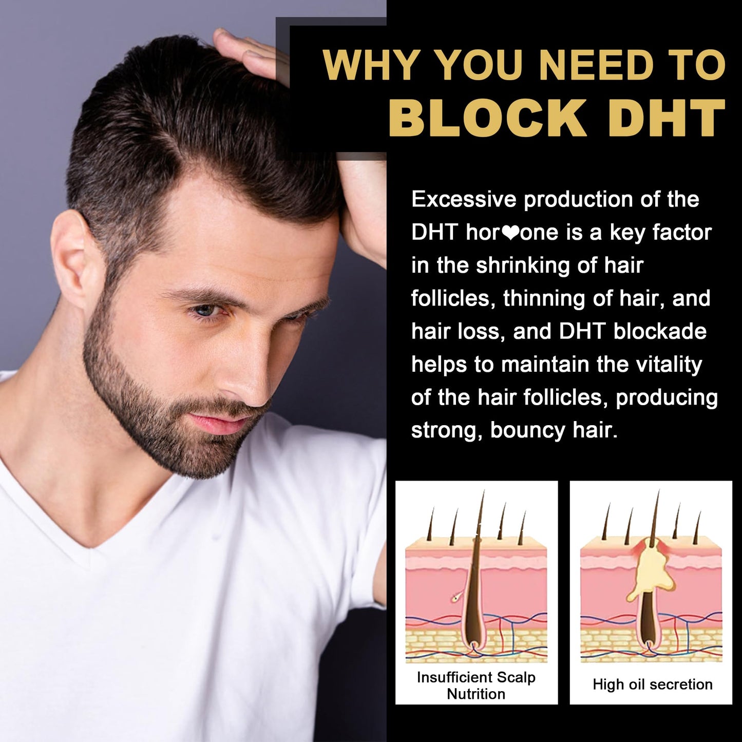 DHT Blocker Gummies Hair Growth Supplement, Super Potency Saw Palmetto & Biotin 10000 mcg for Women & Men, Plus 12 Proprietary Blend - Prevent Hair Loss, Blocking DHT Receptors, Balance