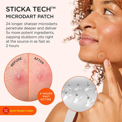 ZitSticka Killa Acne Extra Strength Microdart Pimple Patches For Face, 4 Ct