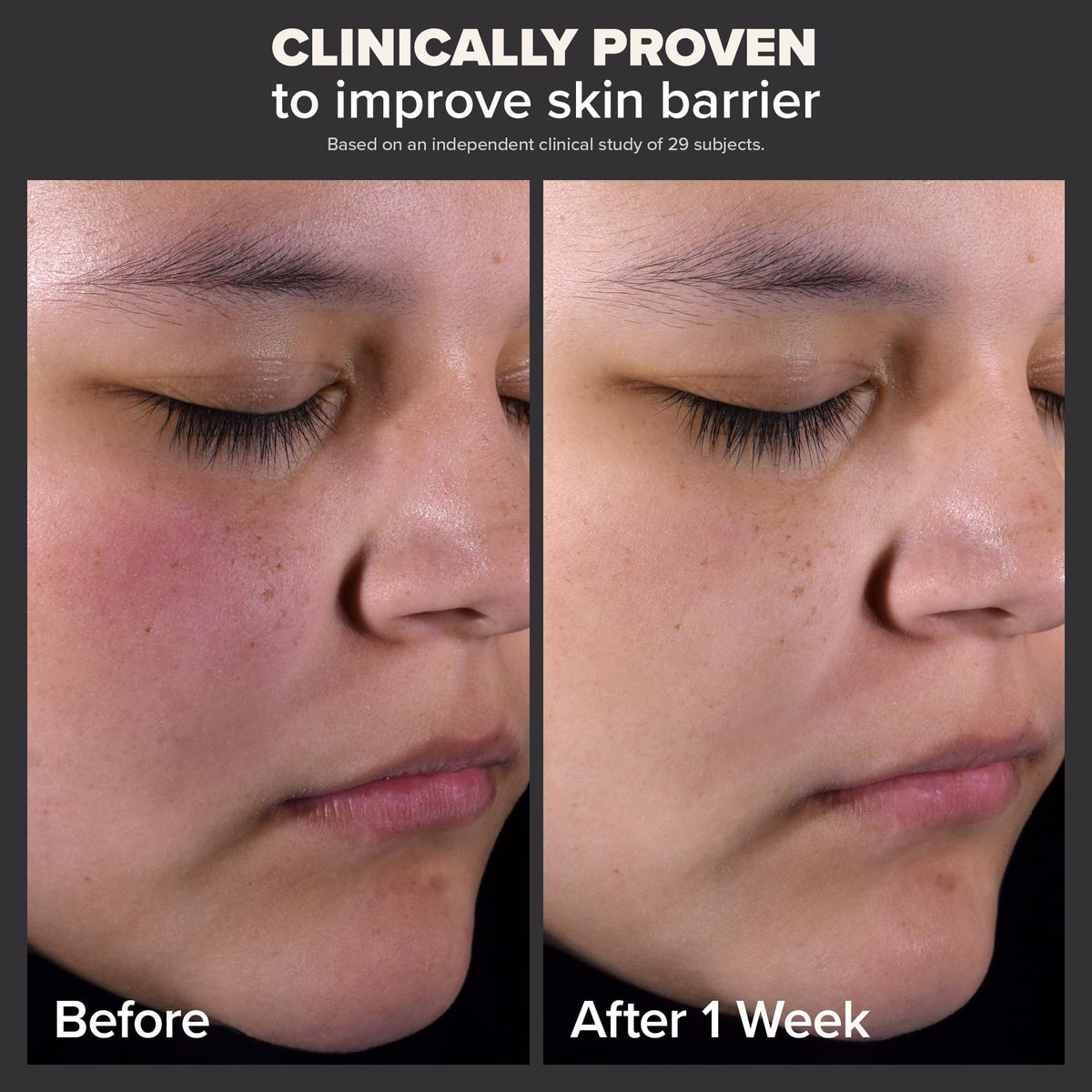 Paula's Choice Skin Perfecting 2% BHA Liquid Salicylic Acid Exfoliant, Gentle Facial Exfoliator