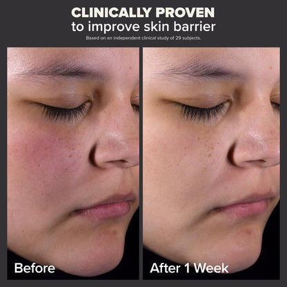 Paula's Choice Skin Perfecting 2% BHA Liquid Salicylic Acid Exfoliant, Gentle Facial Exfoliator
