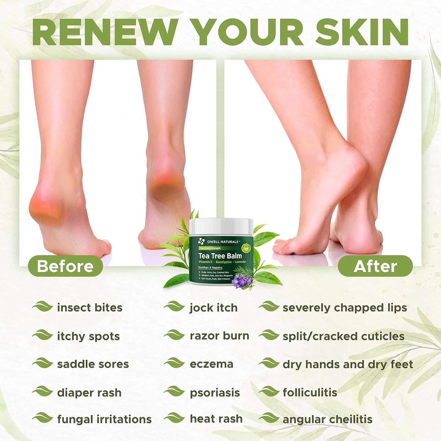Owell Naturals Tea Tree Antifungal Balm – Extra Strength for Athlete’s Foot, Jock Itch, Ringworm & Skin Fungus – Soothing for Itchy, Dry, Cracked Skin, Feet & Body, 2 oz