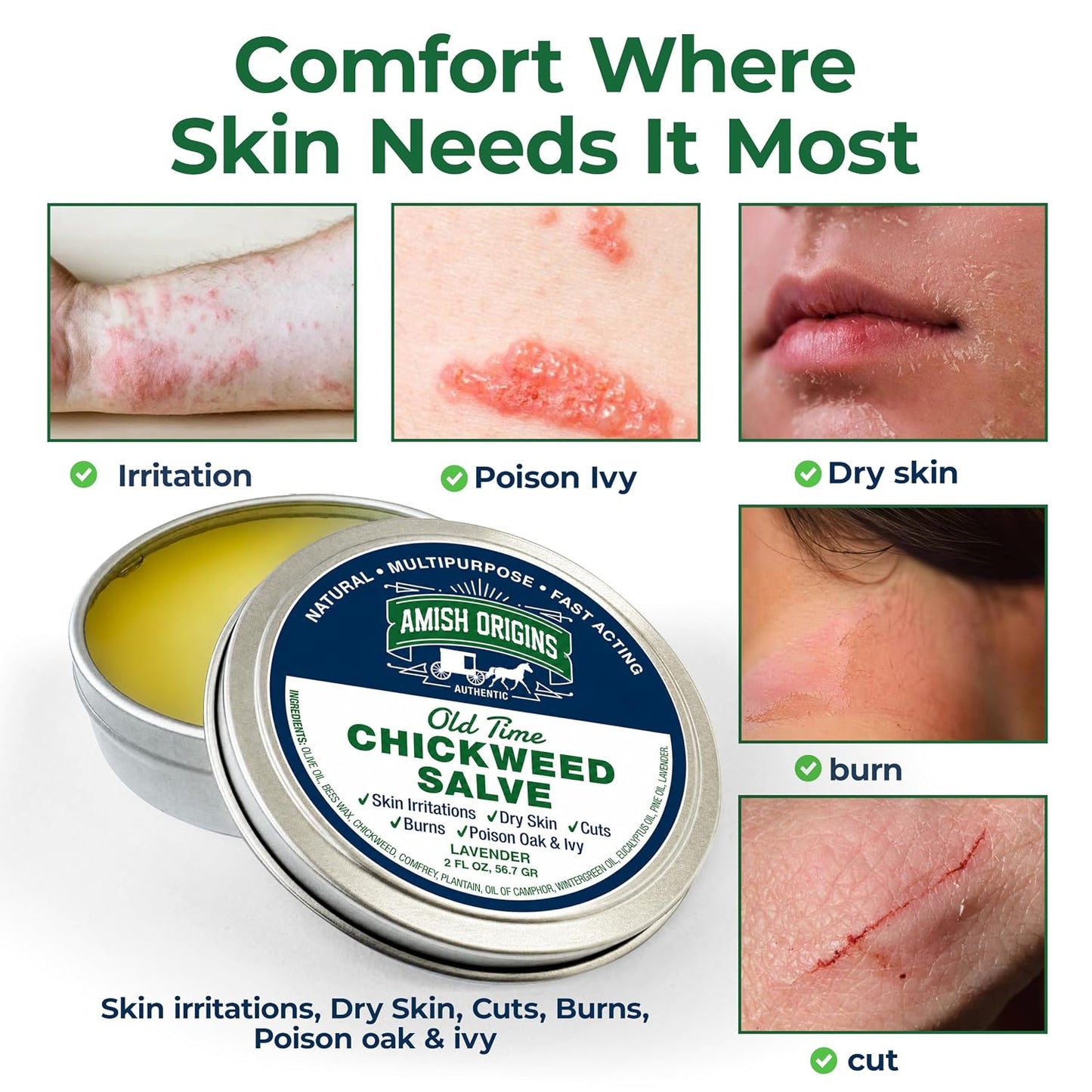 Amish Origins Old Time Chickweed Salve 2 oz- The Ultimate Poison Ivy/Poison Oak Blocker, Healing Salve for Skin Disorder, Irritations, Burns, Minor Cuts