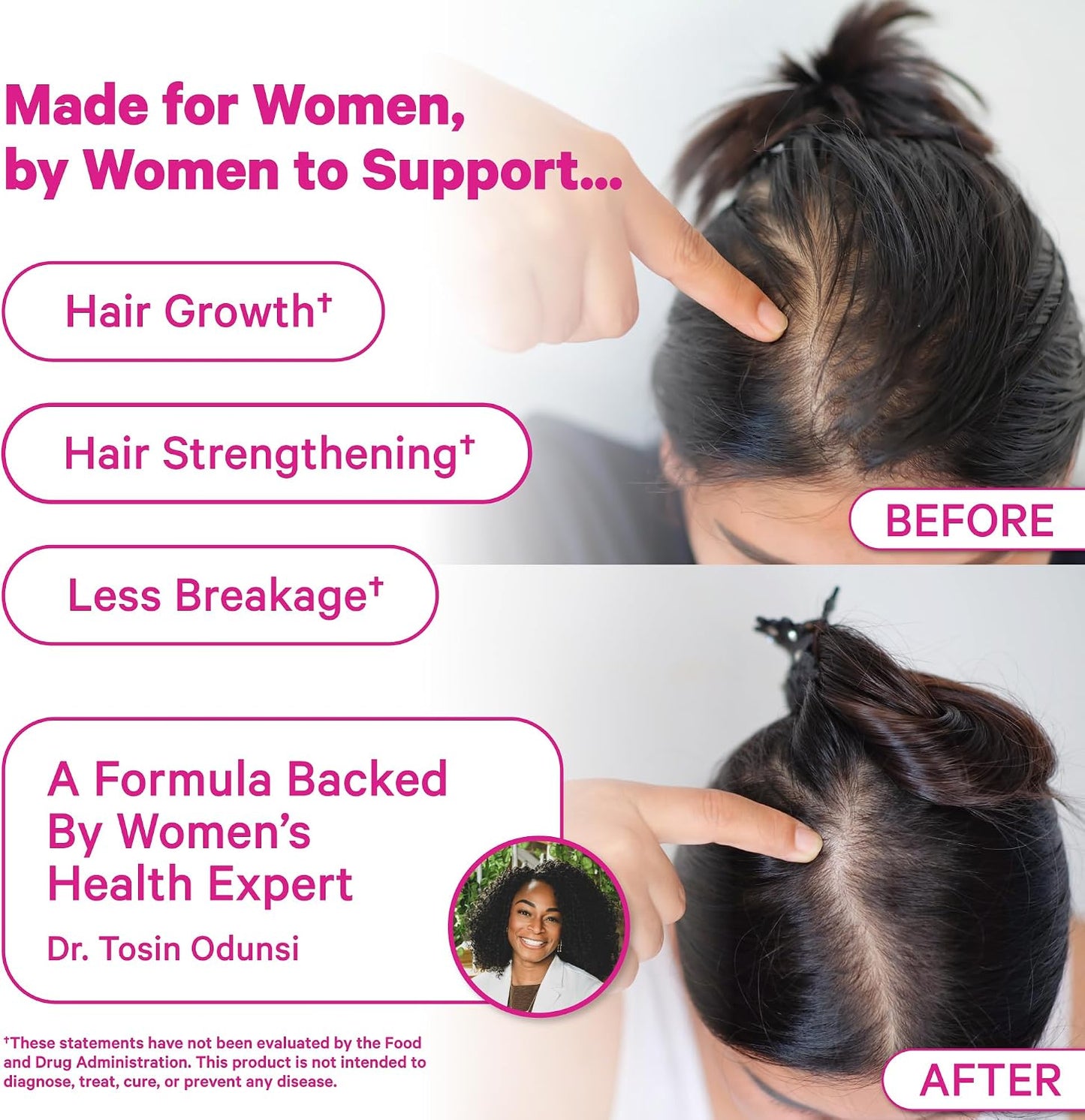 Pink Stork Postpartum Hair Loss Gummies, 60 Count | Biotin, Pantothenic Acid, Vitamin E, B6, B12, Breastfeeding-Friendly, Hair Growth + Regrowth Support