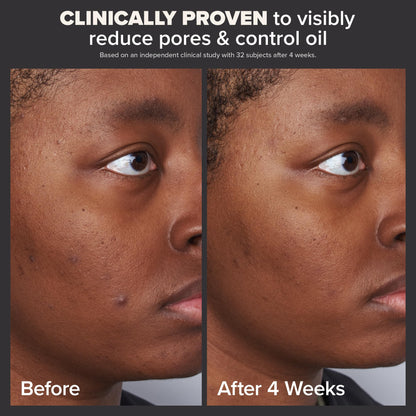 Paula's Choice Skin Perfecting 2% BHA Liquid Salicylic Acid Exfoliant, Gentle Facial Exfoliator