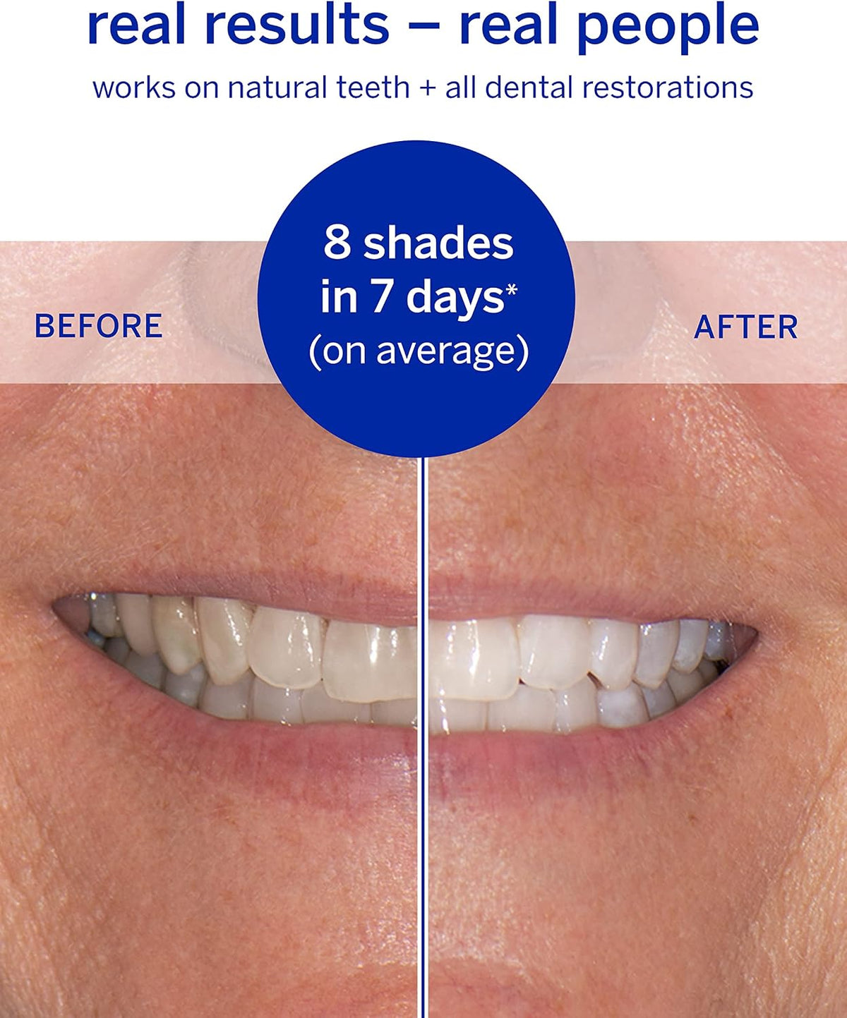 Supersmile Dissolving Superstrips, Professional Teeth Whitening Strips