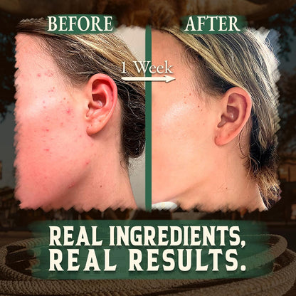 Wrath & Remedy Wagyu Beef Tallow for Cooking (14 oz) & Organic Beef Tallow for Skin - 4 OZ (Eucalyptus)