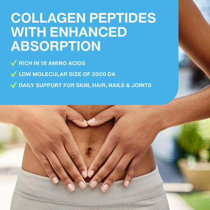 Mobility Collagen Peptides Powder - Glucosamine, Chondroitin, Hyaluronic Acid & Liposomal Vitamin C Joint Bone & Cartilage Support Grass-Fed Type I & III Keto & Paleo 28 Servings, 11.83 oz