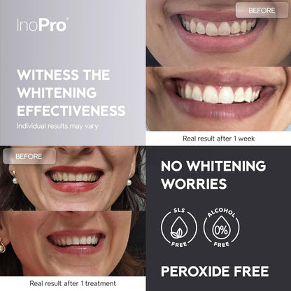 InoPro Advanced Teeth Whitening 21 Treatments Kit + Natural Whitening Hydroxyapatite Toothpaste with Probiotic for Sensitive Teeth 5oz