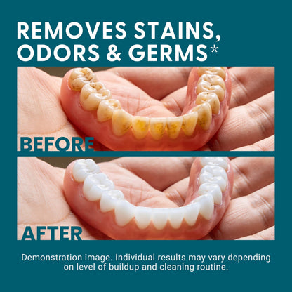 Retainer Cleaner Tablets, Denture Cleaner, Mint, 4 Month Supply by M3