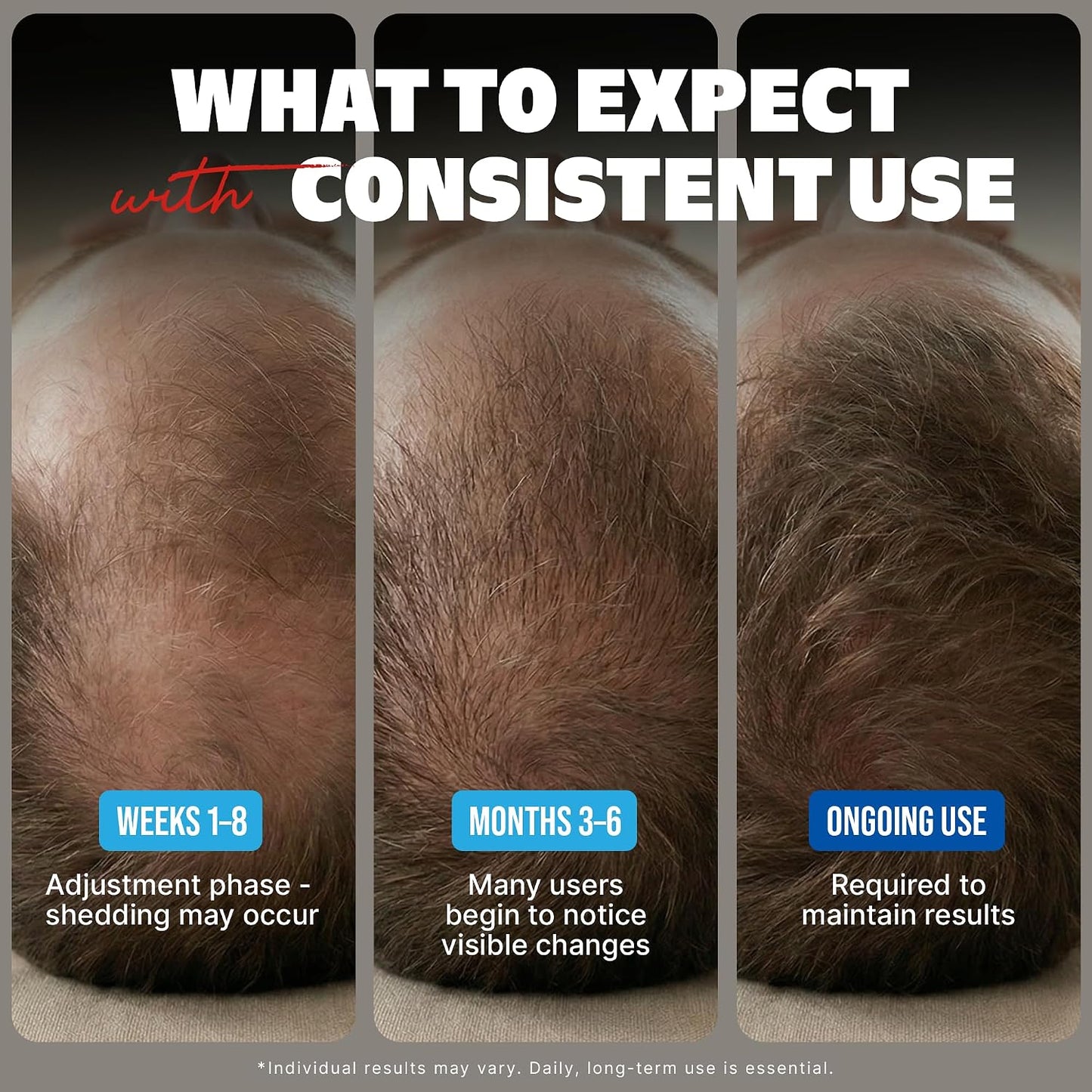 Kirkland Minoxidil for Men Liquid, Extra Strength Hair Regrowth Treatment 5%, 6 Months Supply - Upgraded Dropper Applicator and Bonus Free Guide Included