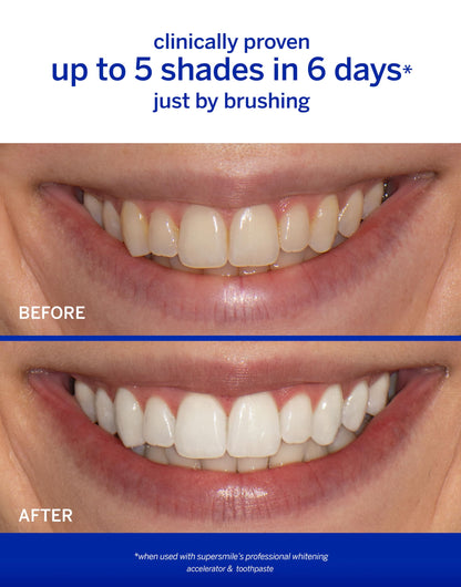 Supersmile Original Mint Whitening Toothpaste, 8 Oz, Whitens 6 Shades