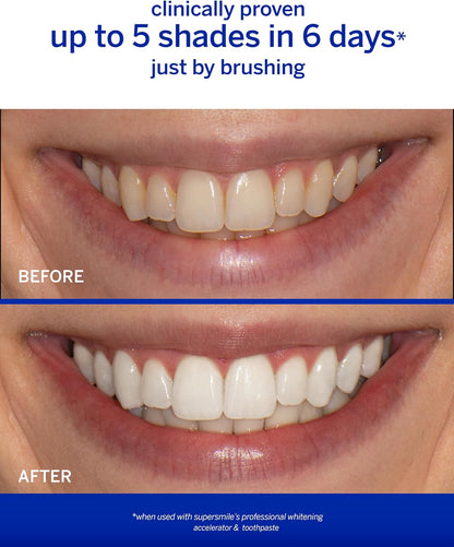 Supersmile Wild Mint Whitening System, 8 Oz Toothpaste + Accelerator