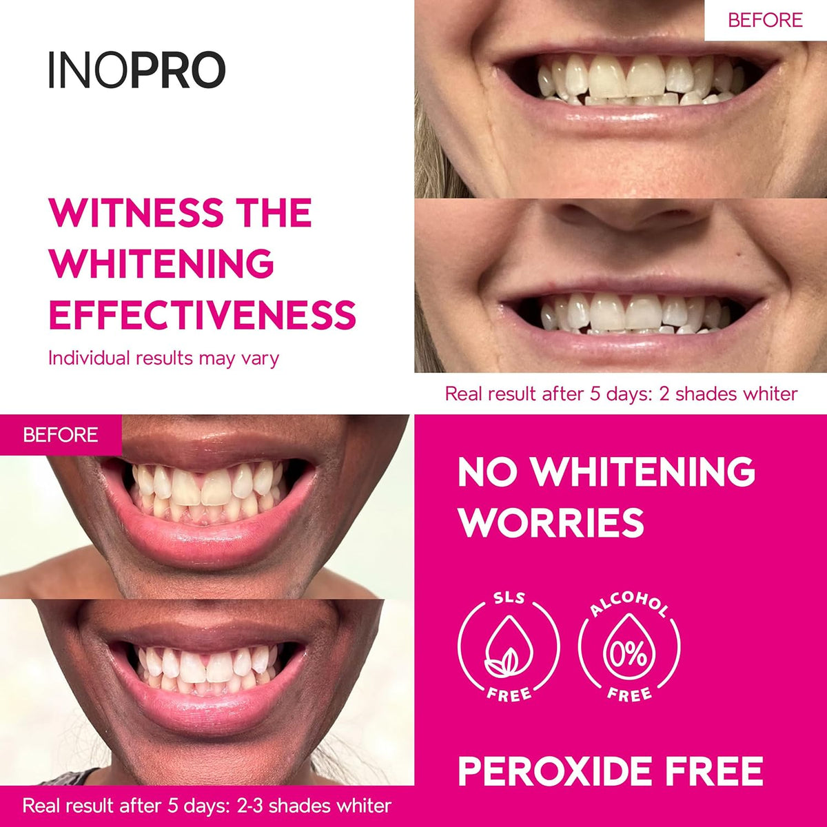 2-in-1 Teeth Whitening Strips Kit 35 Treatments - Advanced Teeth Whitening Kit (14 Treatments) + Innovative Teeth Whitening Kit (21 Treatments)