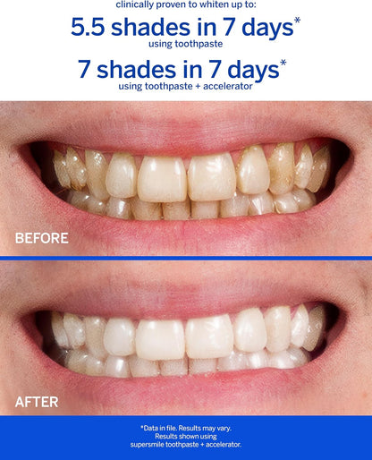 Supersmile Original Mint Whitening Toothpaste, 8 Oz, Whitens 6 Shades