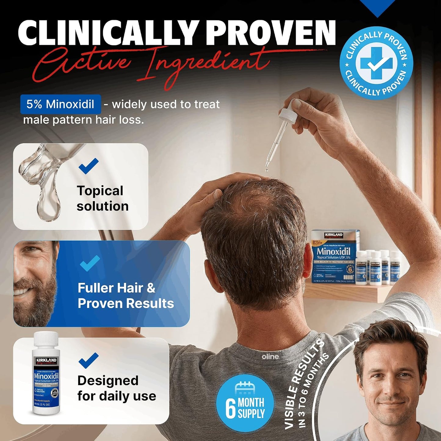 Kirkland Minoxidil for Men Liquid, Extra Strength Hair Regrowth Treatment 5%, 6 Months Supply - Upgraded Dropper Applicator and Bonus Free Guide Included