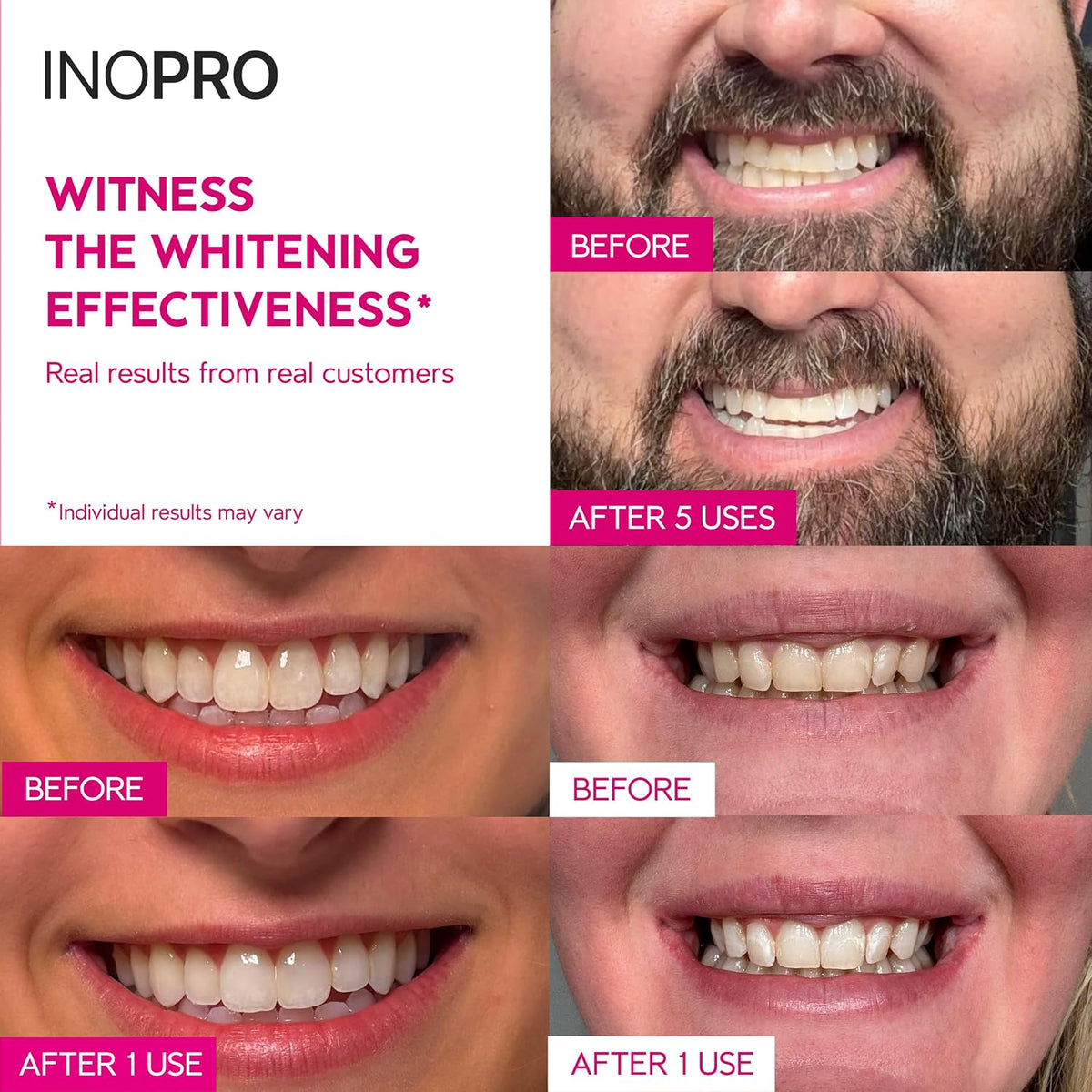 InoPro Green Teeth Whitening Strips - Peroxide Free Whitening Strips - Whitening Without The Harm - Deep Stains Removal - Sensitivity Free - 14 Treatments, 28 Strips, 28 Count (Pack of 1)