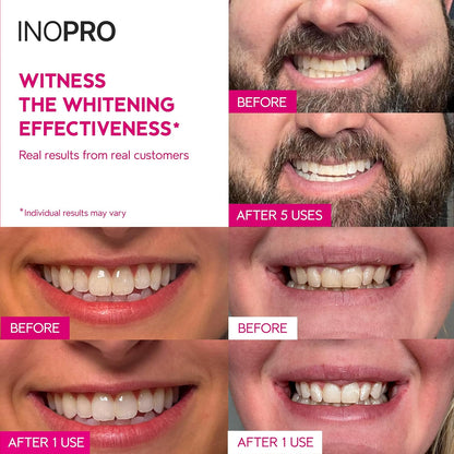 InoPro Green Teeth Whitening Strips - Peroxide Free Whitening Strips - Whitening Without The Harm - Deep Stains Removal - Sensitivity Free - 14 Treatments, 28 Strips, 28 Count (Pack of 1)