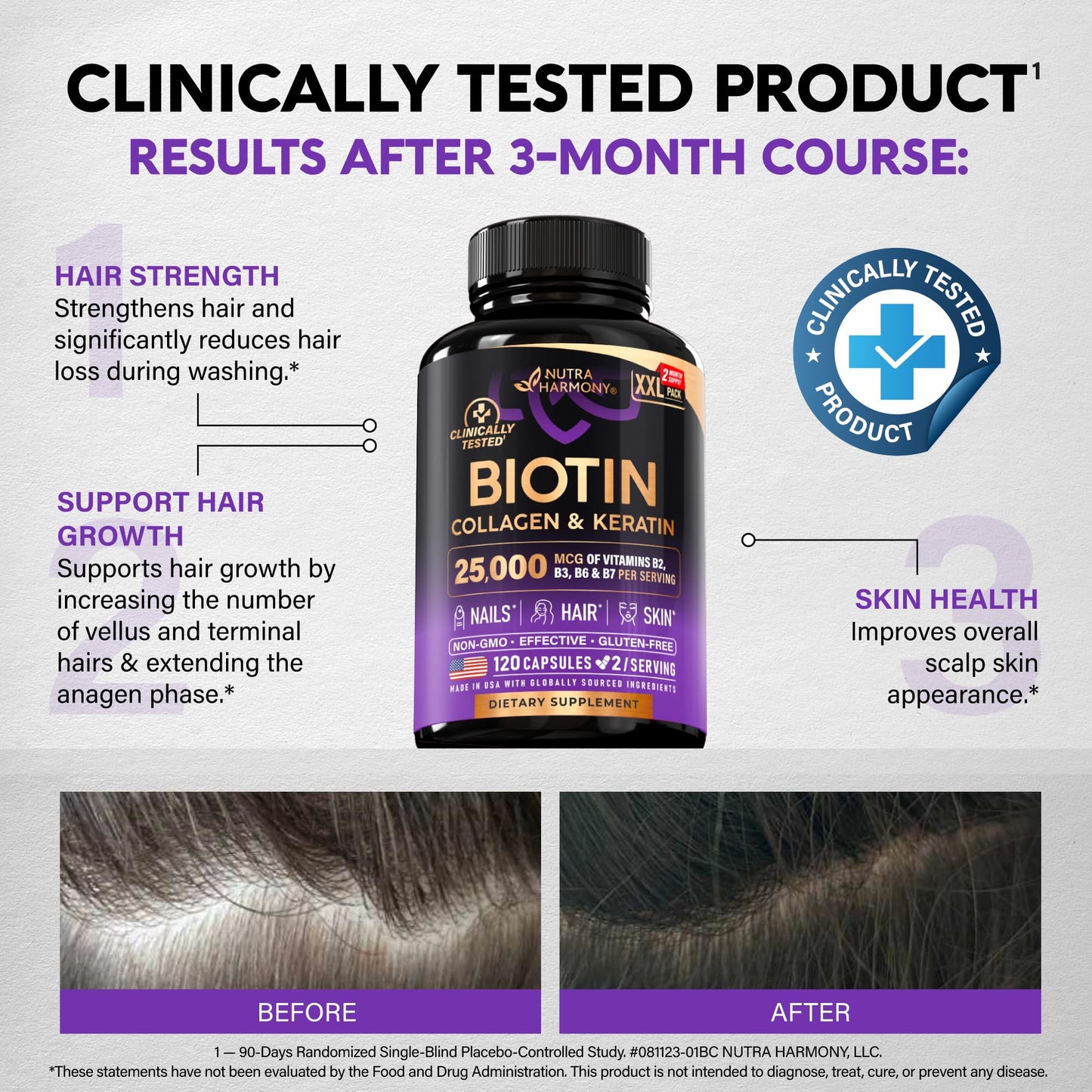 Biotin | Collagen | Hyaluronic Acid | Keratin - Hair Growth & Strength Support Vitamins - Skin & Nails Supplement - Clinically Tested for Men & Women - 25000mcg Vitamins B1, B2, B3, B6 & B7 - 60 Caps