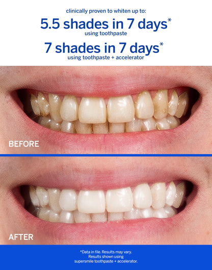 Supersmile Original Mint Whitening Toothpaste, 8 Oz, Whitens 6 Shades