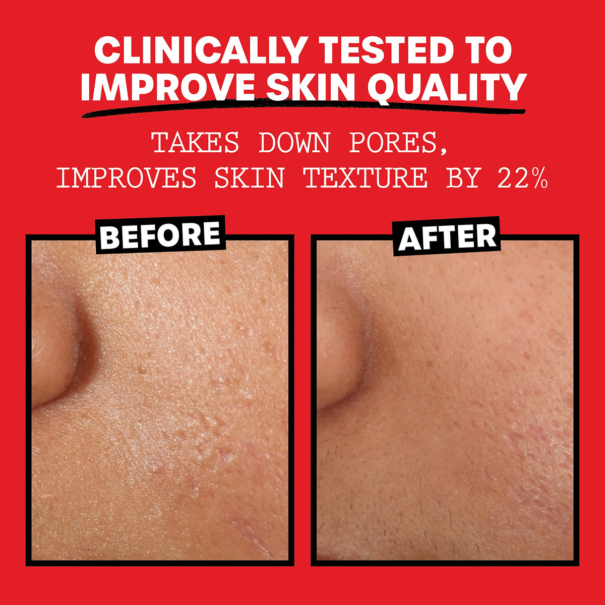 Thayers Alcohol-Free, Hydrating Rose Petal Witch Hazel Facial Toner 12 oz + 3oz