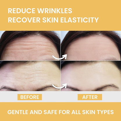 MONIER Forehead Wrinkle Patches Smoothing Overnight - Anti Wrinkle Patches | For Face And Forehead Fine Lines & Frown Lines, With Aloe, Collagen, Vitamin E, Hyaluronic Acid, 12 Pcs