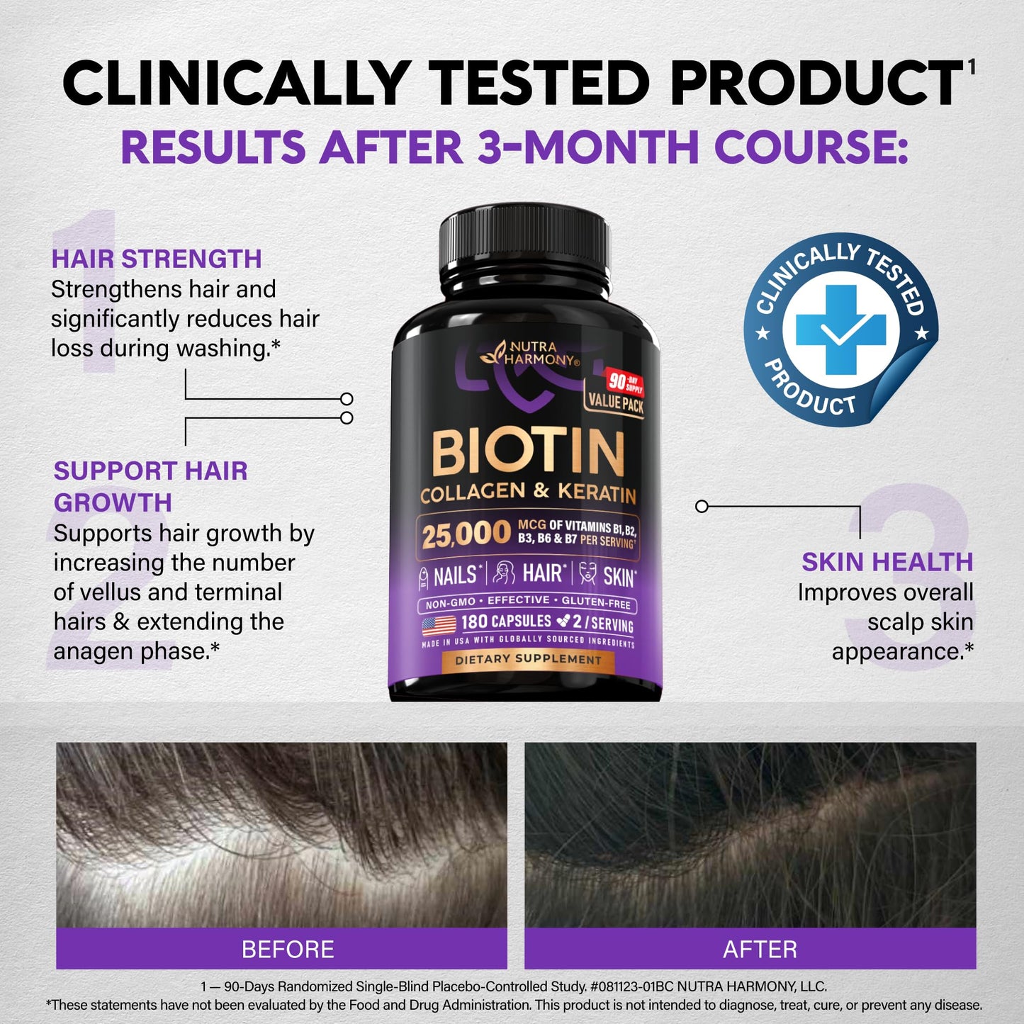Biotin | Collagen | Hyaluronic Acid | Keratin - Hair Growth & Strength Support Vitamins - Skin & Nails Supplement - Clinically Tested for Men & Women - 25000mcg Vitamins B1, B2, B3, B6 & B7 - 60 Caps