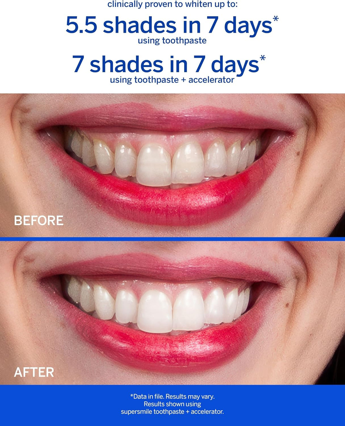 Supersmile Fluoride-Free Whitening Gift Set, Citrus Blast + Travel Bag