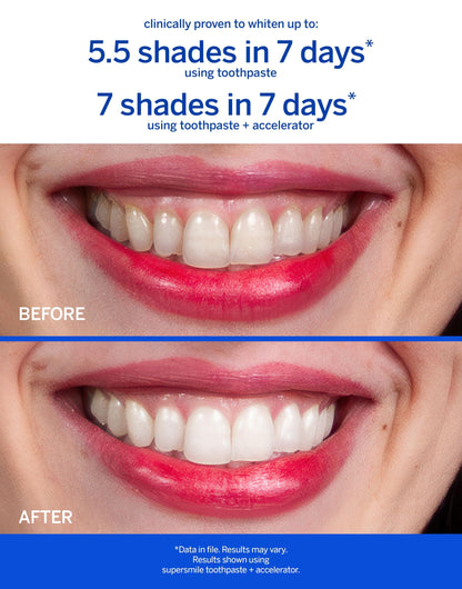 Supersmile Original Mint Whitening Toothpaste, 8 Oz, Whitens 6 Shades