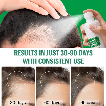 Hair Growth Serum Spray, Natural Hair Growth Spray With Biotin, Batana, Rosemary, and Castor Oil, Caffeine Ginseng Scalp Care Treatment, Thinning Hair Regrowth Thickening for Women Men 4 Fl Oz