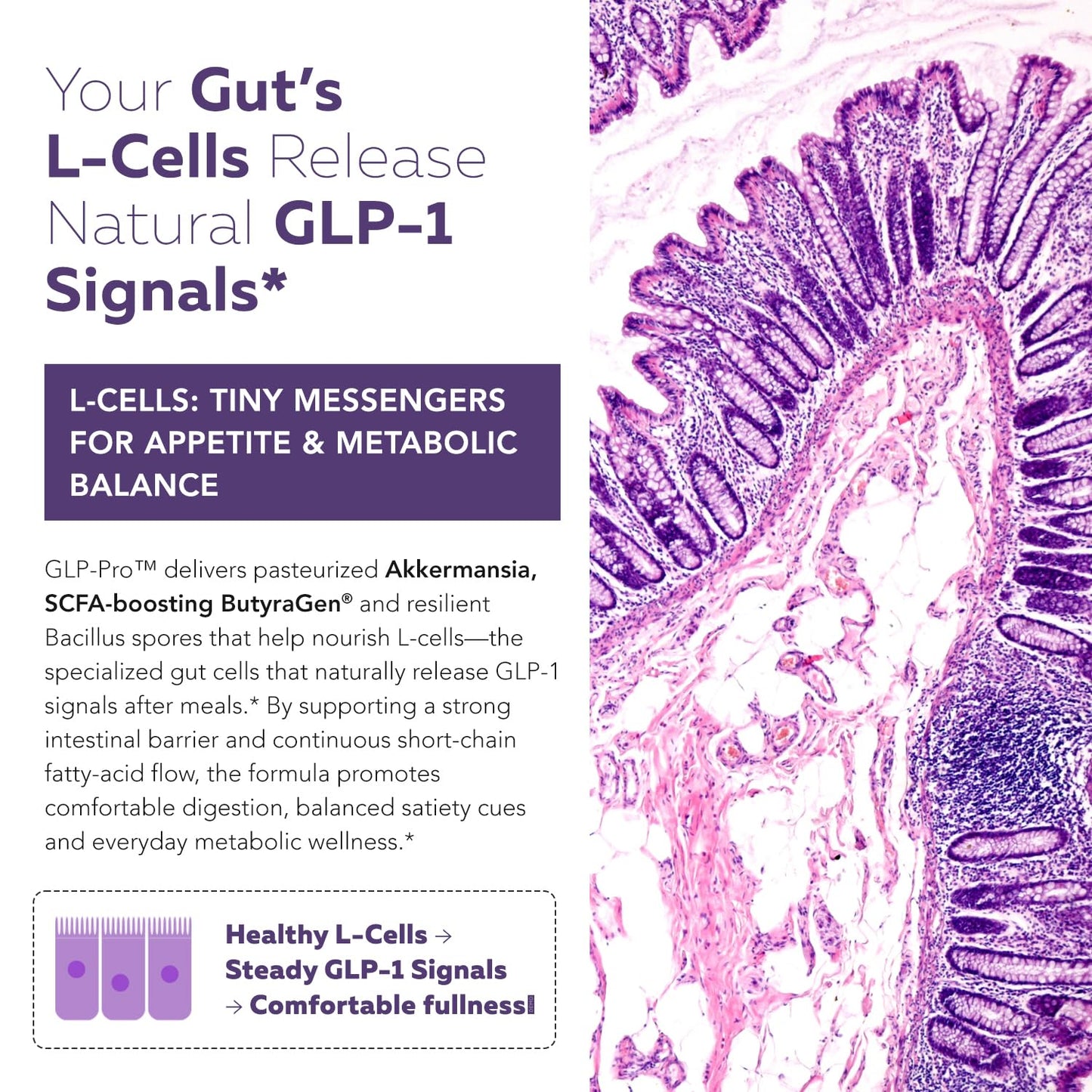GLP-Pro™: Probiotic & Postbiotic Blend for Natural GLP-1 Support — Akkermansia MucT™, ButyraGen® Butyrate Generator & Spore Bacillus — Healthy Appetite, SCFA & Metabolic Balance — 30 Count