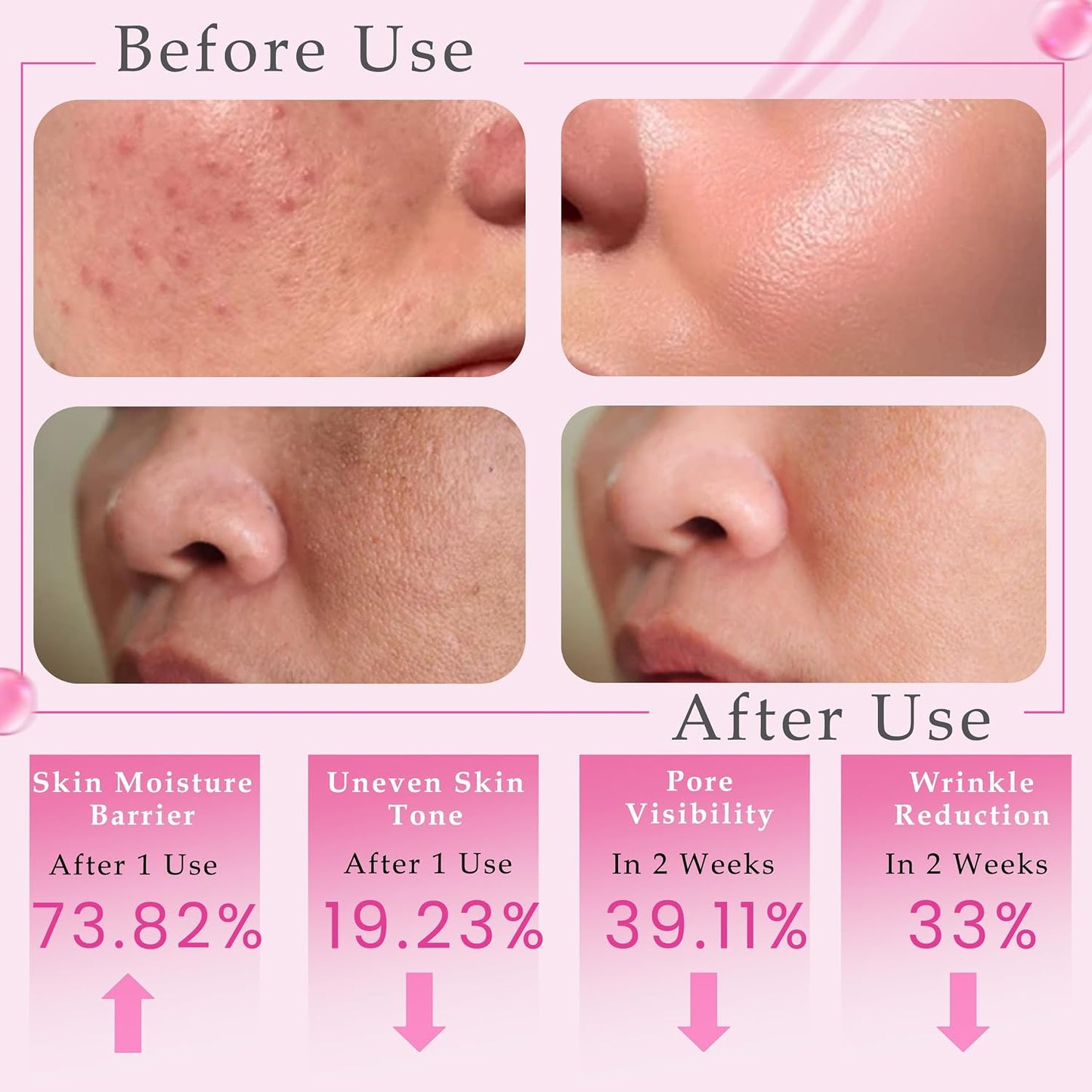 PDRN Pink Peptide Serum — 100% Natural, Vegan PDRN Serum (1 fl oz, 30ml) | Multi-Peptide & Hyaluronic, Skin Barrier Support, Wrinkle & Pore Care, Firming, Hydration Glow, Rose PDRN (Sodium DNA)