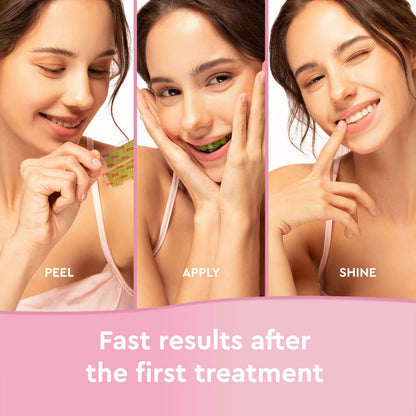 InoPro Teeth Whitening Strips 14 Treatments - Peroxide Free - Whitening Without The Harm